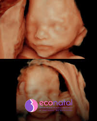 Cada latido, un sueño cumplido🤰🏼💜 👉🏼 En Econatal abrazamos tus sueños,  cuidamos tu historia y recibimos a tu bebé con todo el amor del mundo. 💫  Gracias por permitirnos ser parte de