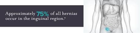 An inguinal hernia does not, and only gets bigger over time. Is It A Groin Strain Or Inguinal Hernia Dr John Uecker