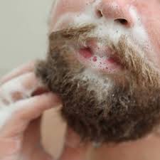 Image result for Beard Dermatitis