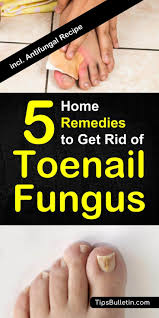 Furthermore, the mild acidic nature of this ingredient may help. How To Get Rid Of Toenail Fungus 5 Home Remedies