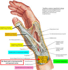 We did not find results for: De Quervain Syndrome Causes Symptoms Diagnosis Treatment Exercises Surgery