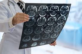 În 2019, paștele a fost sărbătorit pe data de 19 aprilie. Boala Alzheimer Centrokinetic