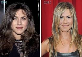 صور أشهر وأجمل مشاهير هوليوود قبل وبعد عمليات التجميل مارأيكم Jennifer Aniston Nose Job Jennifer Aniston Nose Celebrity Plastic Surgery