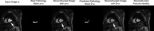 Semi Supervised Pathology Segmentation With Disentangled Representations Springerlink We are working on a comprehensive pati practice.