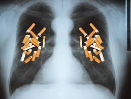 If cancer is diagnosed, other tests will be performed to stage and grade the tumor so that the appropriate treatment can be delivered. Ct Test For Hidden Lung Cancer Is Cost Effective But Not Covered For Many Likely To Benefit Harvard Health