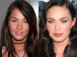 Aug 16, 2020 · celebrity plastic surgery: Most Famous Celebrities Before And After Cosmetic Treatments Storat
