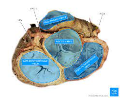 The anterior interventricular sulcus is visible on the anterior surface of the heart, whereas the posterior interventricular sulcus is visible on the posterior surface of the heart. Heart Anatomy Structure Valves Coronary Vessels Kenhub
