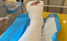 Tangan dapat membangun kesan pertama yang begitu kuat, baik melalui jabat tangan maupun lambaian tangan yang hangat. Bernama Tunku Azizah Terseliuh Kaki Kiri Ketika Bermain Golf