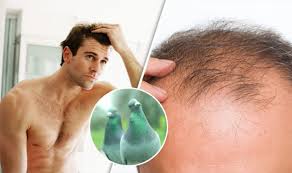According to cowpathy, fresh urine of virgin cow is highly therapeutic in nature and capable of addressing a wide range of health issues including hair loss. Baldness Cures Men Have Tried Over The Years But Do The Hair Loss Treatments Work Express Co Uk