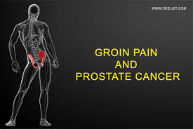 There are a number of different treatments doctors recommend. Groin Pain And Prostate Cancer