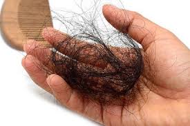 Apa lagi yang perlu anda ketahui tentang rambut? 10 Tips Mengatasi Rambut Rontok Secara Alami Sukoharjonews Com