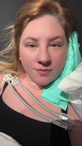 Silent Mastoiditis Ear Lump