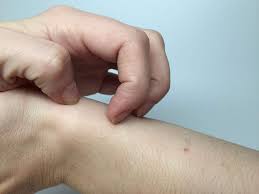 The scratcher will usually use something sharp to the touch but not pure metal, for example. Scratching The Skin Primes The Gut For Allergic Reactions To Food Mouse Study Suggests National Institutes Of Health Nih