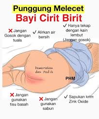 Ubat paha melecet in english, ubat paha melecet maksud, ubat paha melecetomed, ubat kurap celah paha, random image. Punggung Melecet Bayi Cirit Birit Klinik Putramedic Facebook