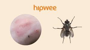 Maybe you would like to learn more about one of these? 11 Tipe Bekas Gigitan Serangga Yang Ada Di Sekitar Kita Biar Lebih Waspada Akan Bahayanya