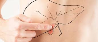 We did not find results for: Gejala Batu Empedu Guesehat Com