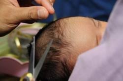 Welcoming Your Newborn - Fiqh Of Aqeeqah, Naming, Tahneeq, Circumcision And  So On - A Comprehensive Manual | Pdf
