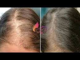 عشبة أوصى بها الرسول توقف تساقط الشعر تنبت تملأ الفراغات وتطول الشعر في أسبوع youtube behind ear tattoo ear tattoo hair wrap