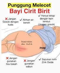 Najis bayi yang normal akan berwarna kekuningan jika dia diberi susu badan. Public Health Malaysia Jika Bayi Alami Cirit Birit Mereka Akan Menangis Kesakitan Apabila Punggung Dibersihkan Sebenarnya Mereka Menangis Bukan Kerana Cirit Birit Tetapi Akibat Punggung Yang Melecet Perhatikan Permukaan Kulit Yang