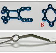 First Report on Rigid Plate Fixation for Enhanced Sternal ...