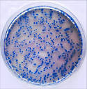 Growth of Streptococcus mitis seen as small, flat, hard colonies ...