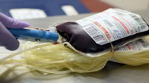 Image result for Plasma Transfusion