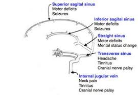 The main risk factors for the development of cvst are gestational or perinatal complications (24. Cerebral Venous Thrombosis Wikem