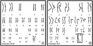 Prior knowledge question (do this before using the gizmo.)[note: Exploring Contemporary Issues In Genetics Society Karyotyping Biological Sex Gender