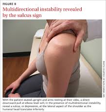 Image result for Shoulder Instability Exam