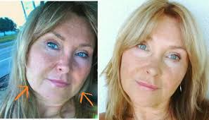 Obviousiy as ceiebrities they had access to the very best ceieb hairstyiists and makeup. Double Chin Best Hairstyles For Sagging Jowls Novocom Top
