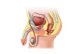 Tanto el sistema reproductor masculino como el sistema reproductor femenino son necesarios para la reproducción. Hipospadias Hidrocele