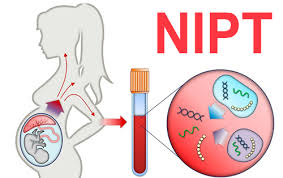 Xét nghiệm sàng lọc NIPT - Những điều bạn cần biết