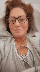 Just had my surgery 2 days ago. When does it stop hurting to move around.  My stomach feels like a waste of space and pulling me down. The pain makes  it hard