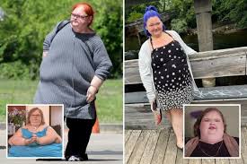 1000-Lb Sisters' Amy Slaton Shows Off Sculpted Jawline After 8St Weight  Loss Journey - Irish Mirror Online