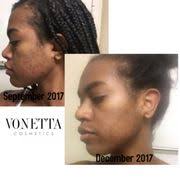 VONETTA COSMETICS