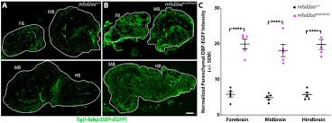 4.6 / 5 stars based on 40,000+ reviews . Suppression Of Transcytosis Regulates Zebrafish Blood Brain Barrier Function Elife