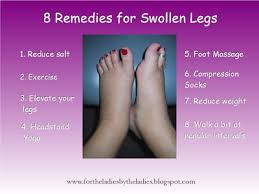 8 Easy Remedies For Swollen Legs How To Cure Swollen Legs Health Tips For Swollen Feet Easy Home Remedies For Swo Swollen Legs Foot Remedies Swollen Feet
