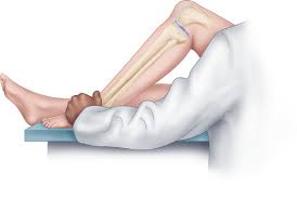 Image result for PCL Sulcus Test