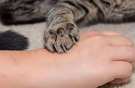 Where to pet a cat. What You Should Do For A Cat Bite Or Scratch Health Essentials From Cleveland Clinic