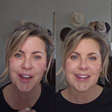 Seint Makeup and Skincare for Facial Eczema and Acne