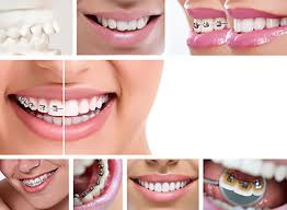 Your orthodontist will be able to give you an accurate estimate of how long your braces treatment will take based on their experience treating patients of similar requirements. What Are The Different Types Of Braces Teeth Straightening Options The Orthodontic Center Of Wayne Dr Sally Song Orthodontist Wayne Nj