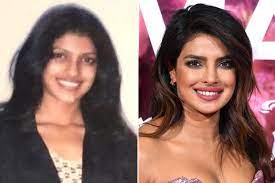 See more of priyanka chopra on facebook. Priyanka Chopra S Before And After Evolution Through The Years