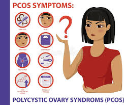 Some women with pcos have cysts on their ovaries. Pcos Symptome Infographic Frauen Gesundheit Vektor Abbildung Illustration Von Schmerz Kopfschmerzen 145792414