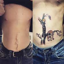 Tattoos breach the skin, which means that skin infections and other complications are possible, including: Can Tattoos Cause Cancer Reddit