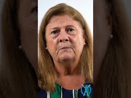 Baldwin W. William, M.D.