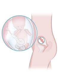 Semana 14 De Embarazo Inatal El Embarazo Semana A Semana