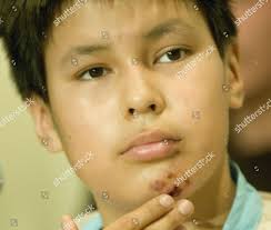 15 Year-old Lance Crowe Wounded Shooting Editorial Stock Photo