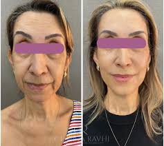 Clínica Ravhi Estética