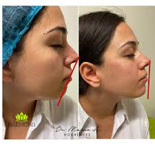 Harmonii Medical Spa