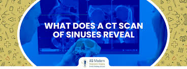 Image result for Sinus CT